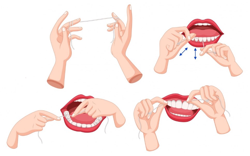 infografía de cómo usar seda dental en 4 simples pasos